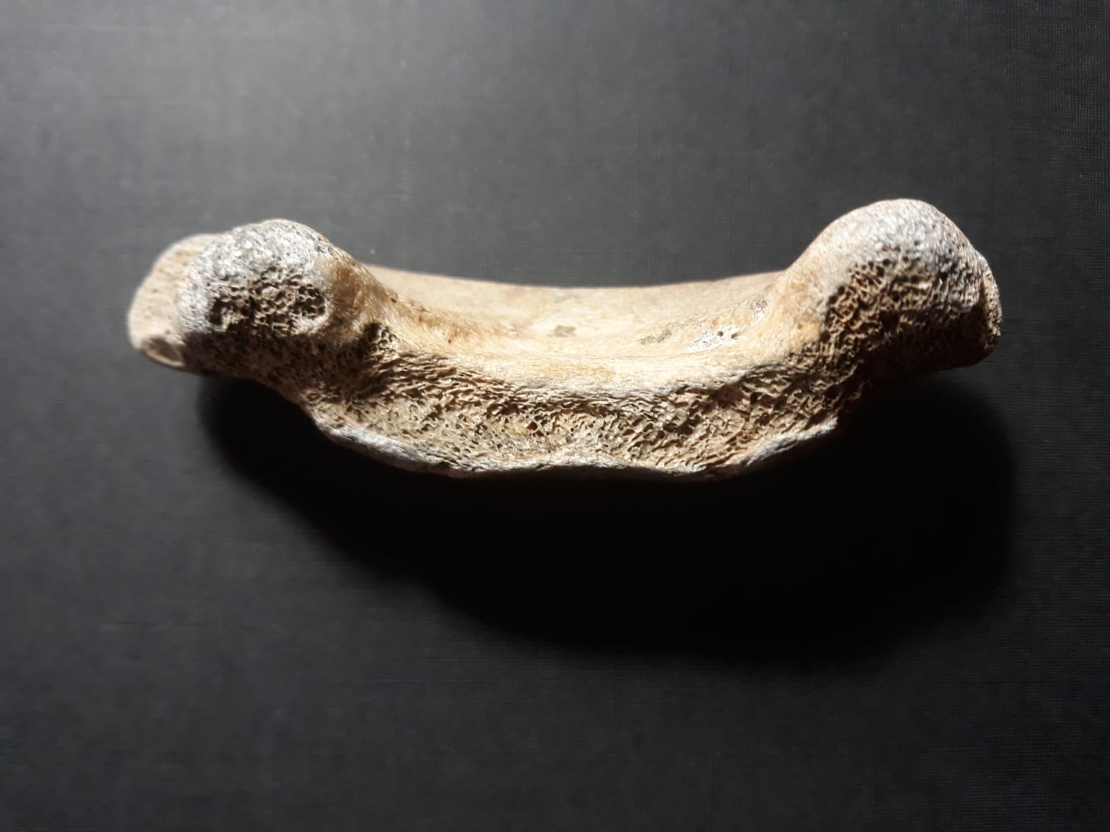 Vertebra?